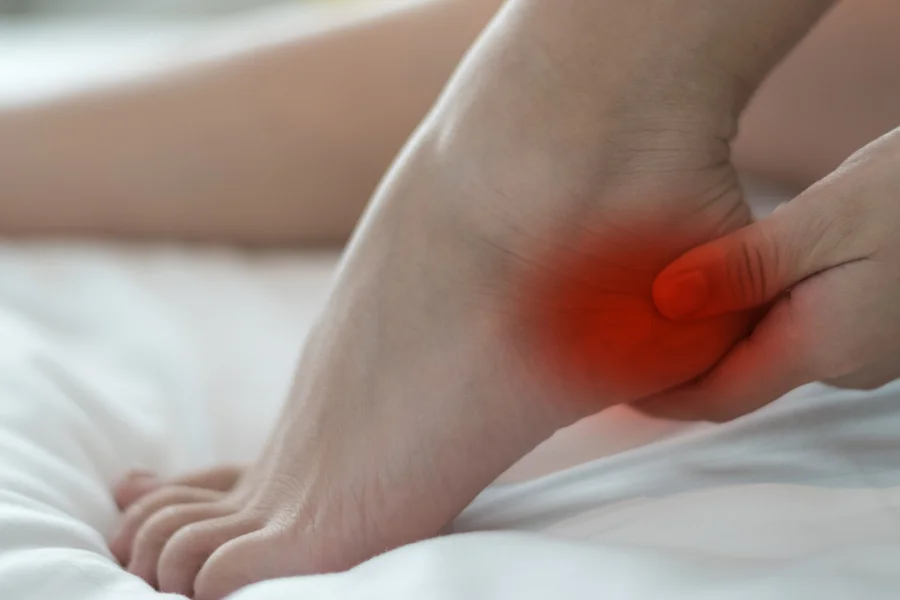 Topuk Dikeni (Plantar Fasiit) Nedir? Belirtileri ve Tedavi Yöntemleri