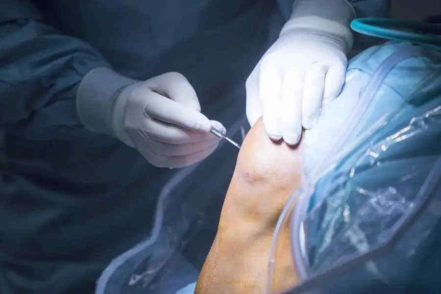 Kalça ve Diz Protezi Cerrahisi Hakkında En Sık Sorulan 10 Soru